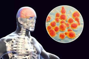 Nuovo allarme meningite: 3 casi e ora scatta la paura, ecco dove