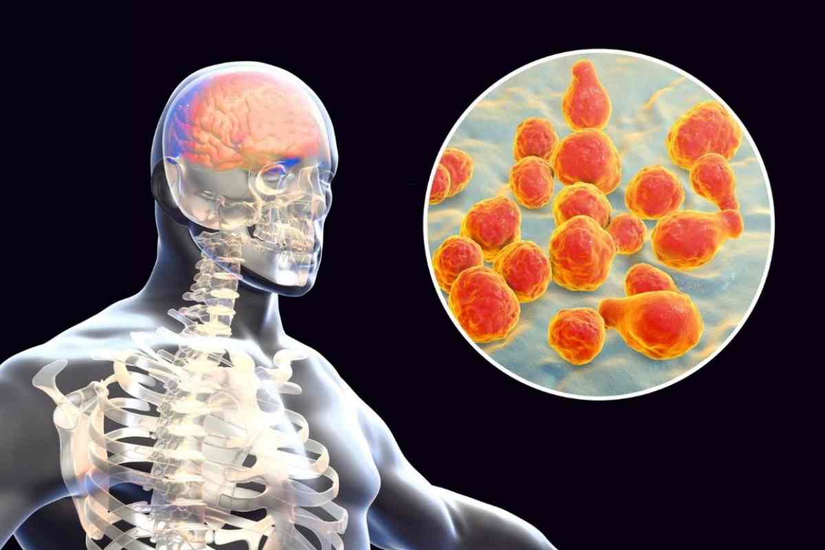 Nuovo allarme meningite: 3 casi e ora scatta la paura, ecco dove